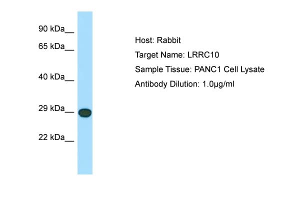 Polyclonal Rabbit anti-Human LRRC10 Antibody (C-Terminus, WB)