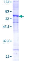 Human CTSL / Cathepsin L Protein (Recombinant GST)