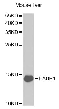 FABP1 / L-FABP Antibody