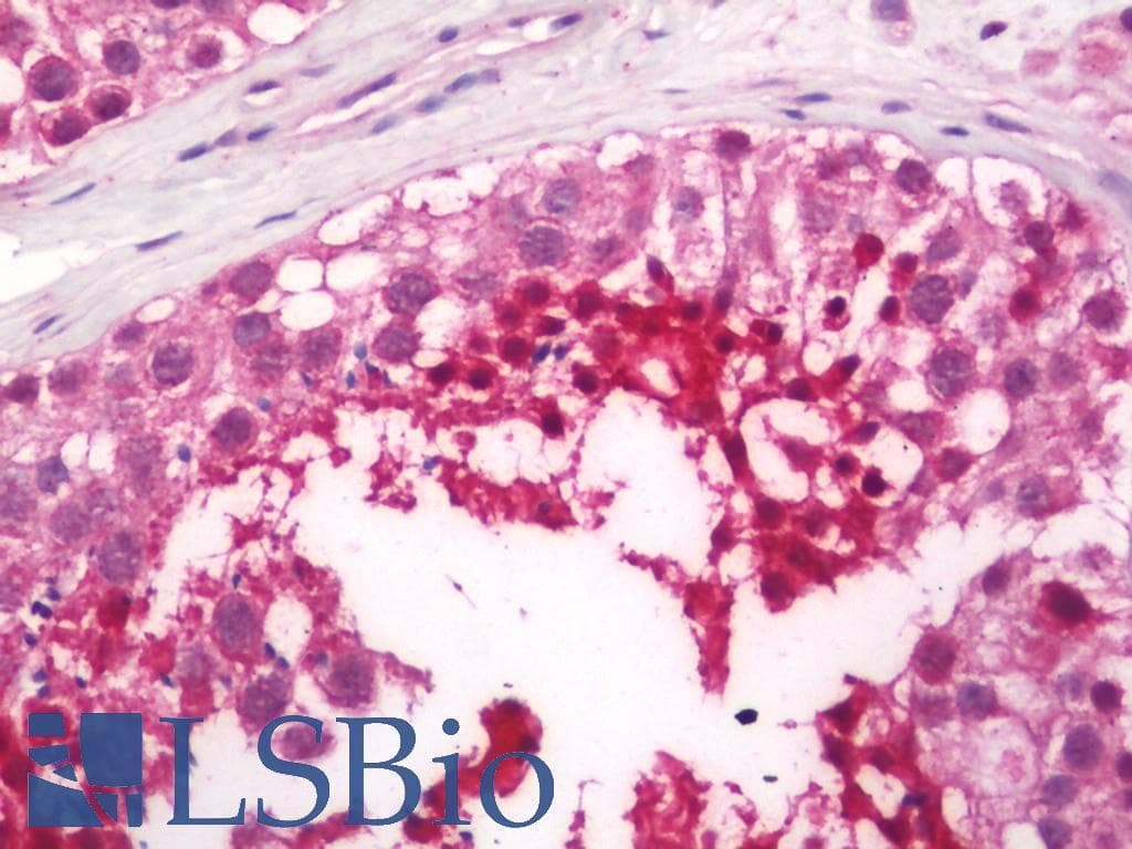 IHC-plus™ PDCL2 Antibody (aa5-237)