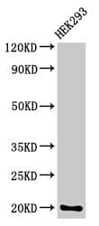 IHC-plus™ Polyclonal Rabbit anti-Human PARK7 / DJ-1 Antibody (IHC, IF, WB)