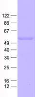 Human UQCRC1 Protein (Recombinant His, N-Terminal)