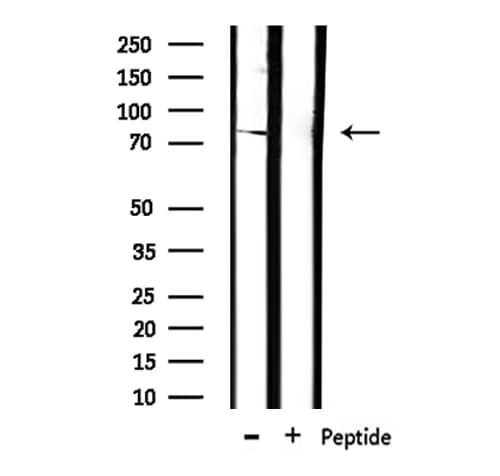 Polyclonal Rabbit anti-Human TLE1 / TLE 1 Antibody (IHC, WB)