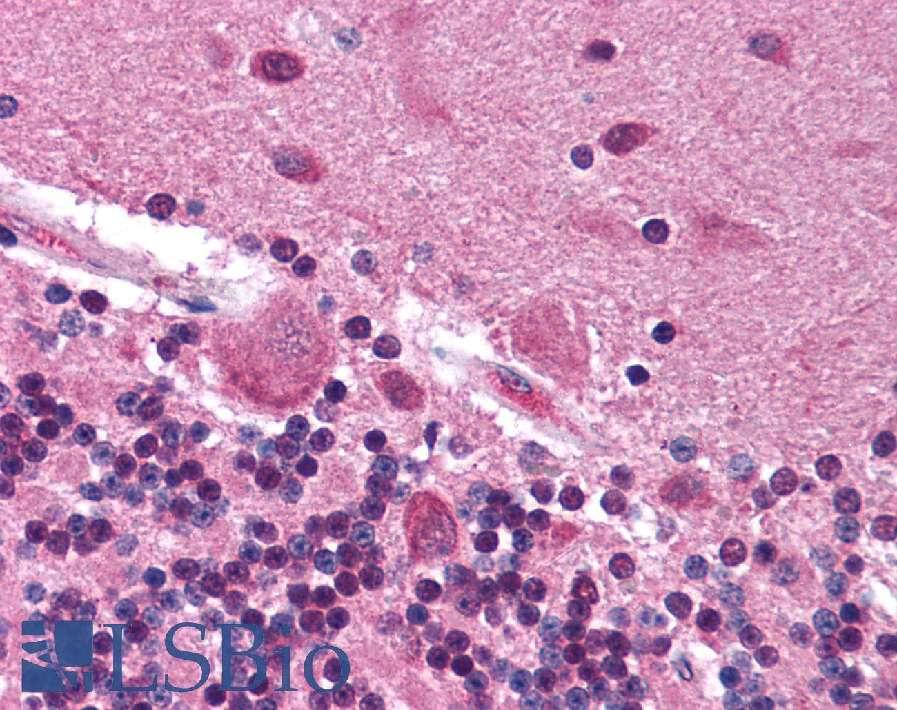 IHC-plus™ SYN / FYN Antibody (aa7-176, clone FYN-59)