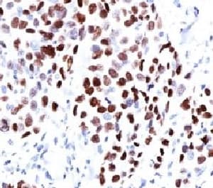 CDKN1A / WAF1 / p21 Antibody (clone WAF21-1)