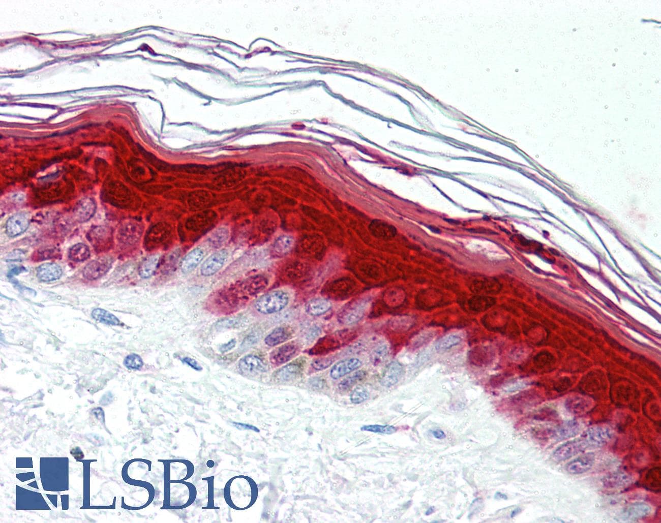 IHC-plus™ Monoclonal Mouse anti-Human S100A7 / Psoriasin Antibody (clone 47C1068, IHC, WB)