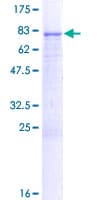 Human FCRL1 Protein (Recombinant GST)