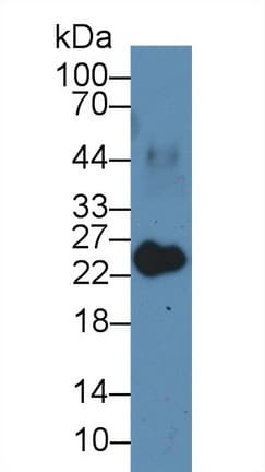 MYL3 Antibody (aa5-181, APC)