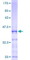 Human RPS25 / Ribosomal Protein S25 (Recombinant GST)