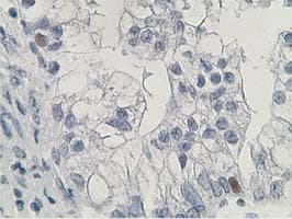 HDHD2 Antibody (clone OTI4G3)