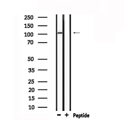 GPR48 / LGR4 Antibody