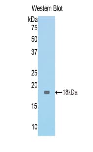 Beta-N-Acetylglucosaminidase Antibody (aa83-222, Biotin)