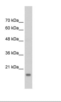 Polyclonal Rabbit anti-Human GP78 / AMFR Antibody (aa110-159, WB)