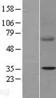 Human SDHB Protein (Over-Expression Lysate Myc-DDK (Flag))