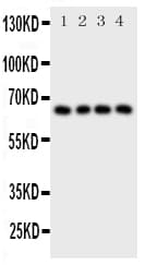 Polyclonal Rabbit anti-Human PTHR / PTHR1 Antibody (aa388-406, IHC, WB)