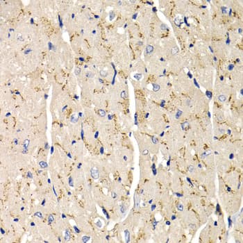 Polyclonal Rabbit anti-Human SFRP2 Antibody (IHC, IF, WB)