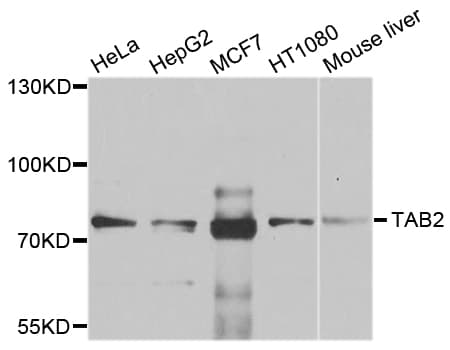 TAB2 Antibody