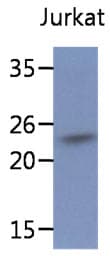 Monoclonal Mouse anti-Human SSR2 Antibody (clone AT31G6, WB)