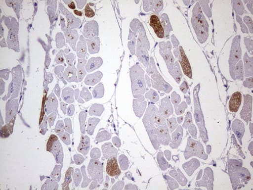 MYL4 Antibody (aa2-197, clone OTI2F6)
