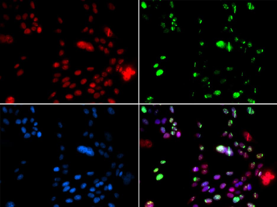 PIAS1 Antibody
