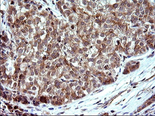 SHBG Antibody (clone OTI1H10)