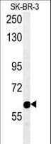 Radil Antibody (aa1044-1071)
