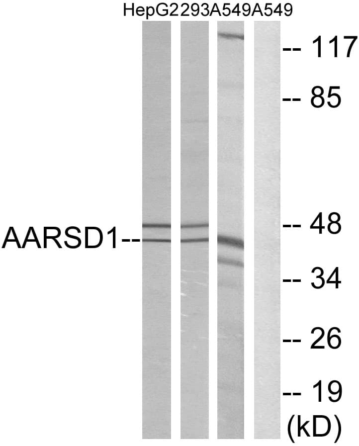 AARSD1 Antibody (aa141-190)