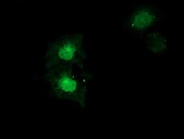 Monoclonal Mouse anti-Human SULT1A1 / Sulfotransferase 1A1 Antibody (clone OTI5F1, IHC, IF, WB)
