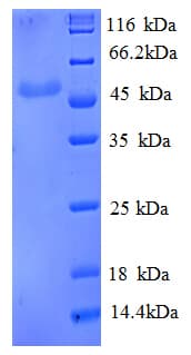 Human ENO3 / Enolase 3 Protein (Recombinant His)