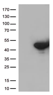 Monoclonal Mouse anti-Human DUSP5 Antibody (clone OTI2F8, aa125-384, WB)