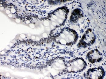 DAXX Antibody