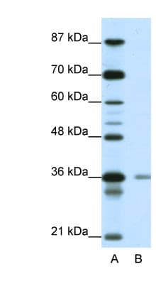 HIF1AN Antibody (N-Terminus)