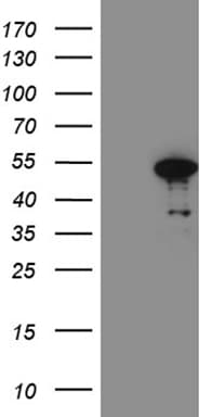 FOXP3 Antibody (clone OTI3E11)