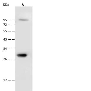 CAPZB / CAPZ Beta Antibody (Preservative Free)