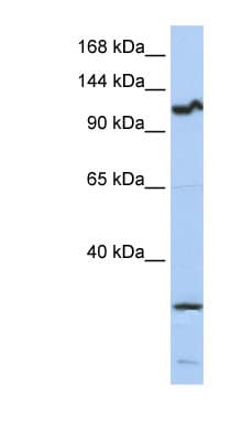 OSMR / IL-31R-Beta Antibody (aa612-661, HRP)