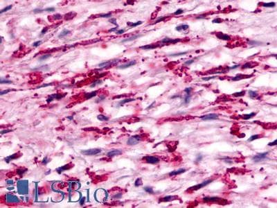 PathPlus™ Polyclonal Rabbit anti-Human GPR160 Antibody (Transmembrane Domain, IHC)