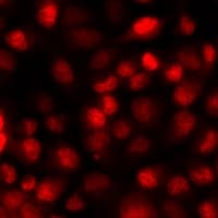 ISLET-1 / ISL1 Antibody