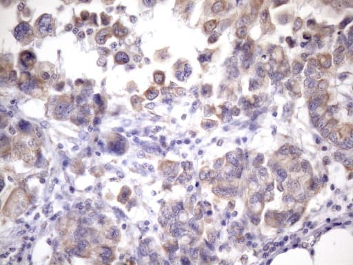 Monoclonal Mouse anti-Human EGLN2 / PHD1 Antibody (clone OTI7H3, IHC, WB)