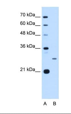 Junctin / ASPH Antibody (aa66-115)