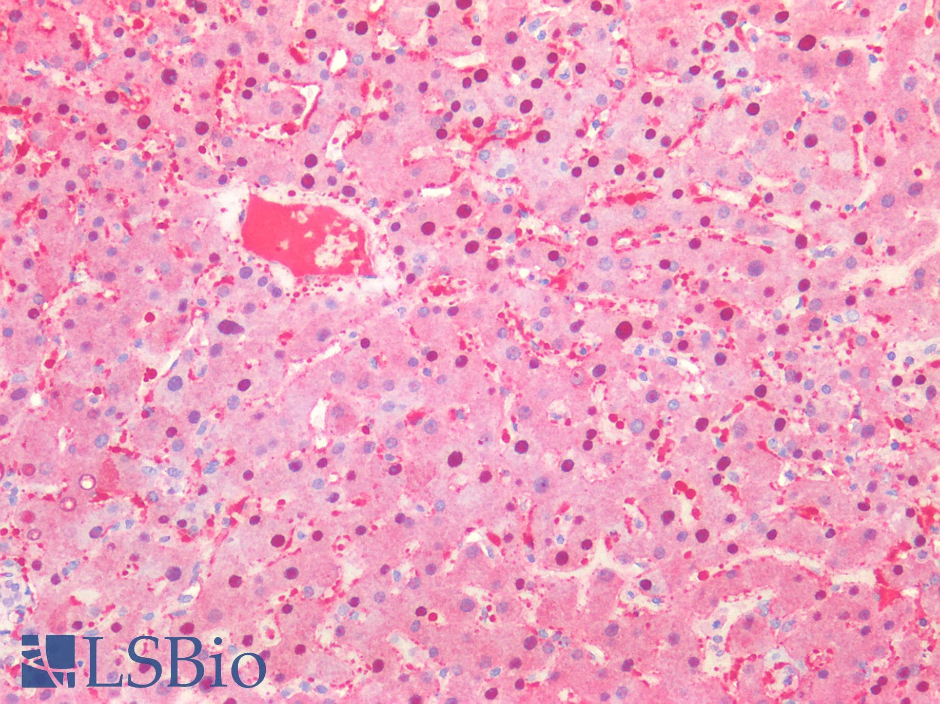 IHC-plus™ PGM1 / Phosphoglucomutase 1 Antibody (clone AT84G2)