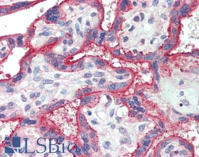 PathPlus™ Polyclonal Rabbit anti-Human CD36 Antibody (IHC, WB)