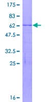 Human RPL8 / Ribosomal Protein L8 (Recombinant GST)