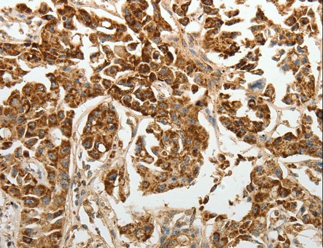SELE / CD62E / E-selectin Antibody