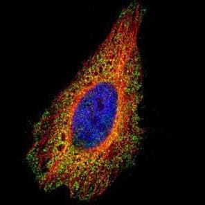IHC-plus™ SNAI1 / SNAIL-1 Antibody (Internal)