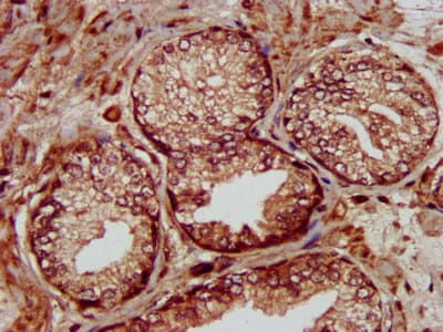 MMADHC / C2orf25 Antibody