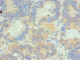 HIP1 Antibody (aa410-690)