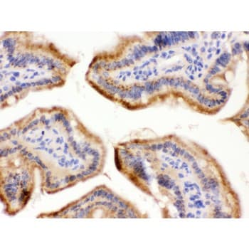 FUT1 / HSC Antibody (aa134-164)