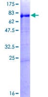 Human PNLIPRP1 Protein (Recombinant GST)