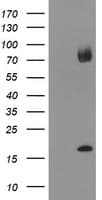 TPD52L3 Antibody (clone OTI2D2)