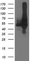DLD / Diaphorase / E3 Antibody (clone OTI6G6)